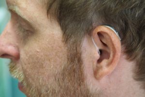 hearing aid closeup